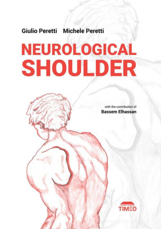 Neurological shoulder