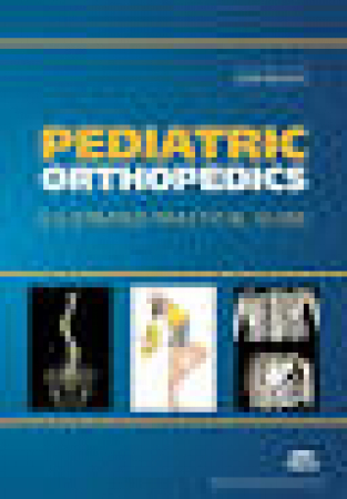 Pediatric orthopedics